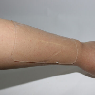 silicone scar sheets  | scar therapy | 2 sizes - Image 4