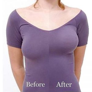 breast lift adhesives