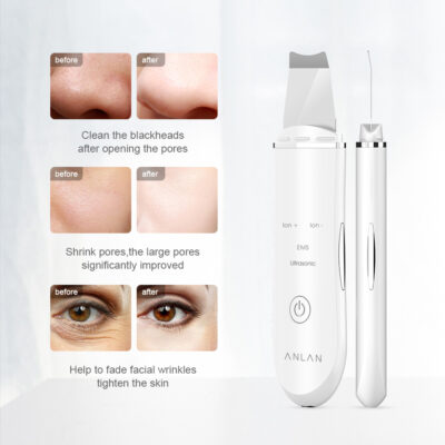 Ultrasonic Deep Skin Face Scrubber,  Facial Pore Cleaner - Image 2