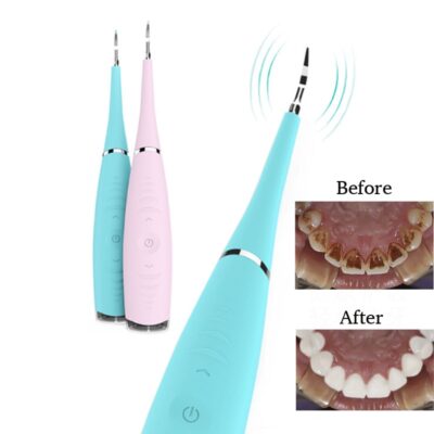 Professional Portable Electric Sonic Dental Scaler, Calculus Remover,  Tooth Stain Remover - Image 2