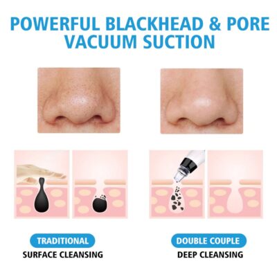 Blackhead Remover Pore Vacuum Cleaner -Upgraded Blackhead Removal Tool Rechargeable - 5 Settings - Image 6