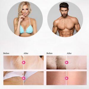 Professional Permanent IPL Epilator Laser Hair Removal