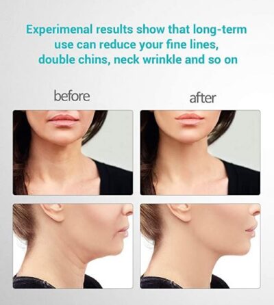 Sonic Face Massager, Skin Tightening Machine, Firming & Toning Device - Image 8